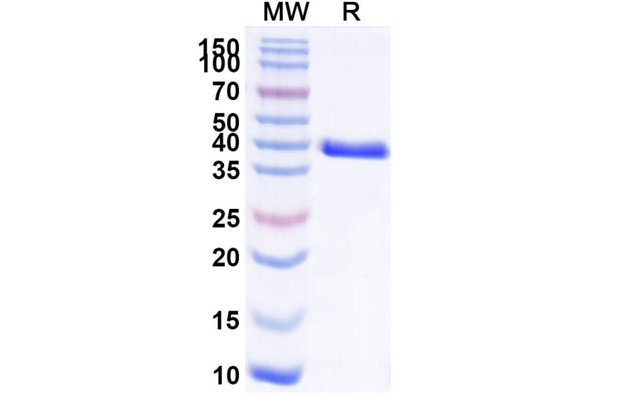 SDS-PAGE - Anti-CEACAM6 Nanobody [L-DOS-47] (A337495) - Antibodies.com