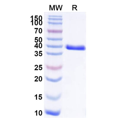 SDS-PAGE - Anti-CEACAM6 Nanobody [L-DOS-47] (A337495) - Antibodies.com