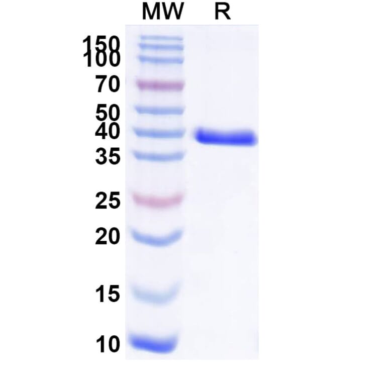 SDS-PAGE - Anti-CEACAM6 Nanobody [L-DOS-47] (A337495) - Antibodies.com