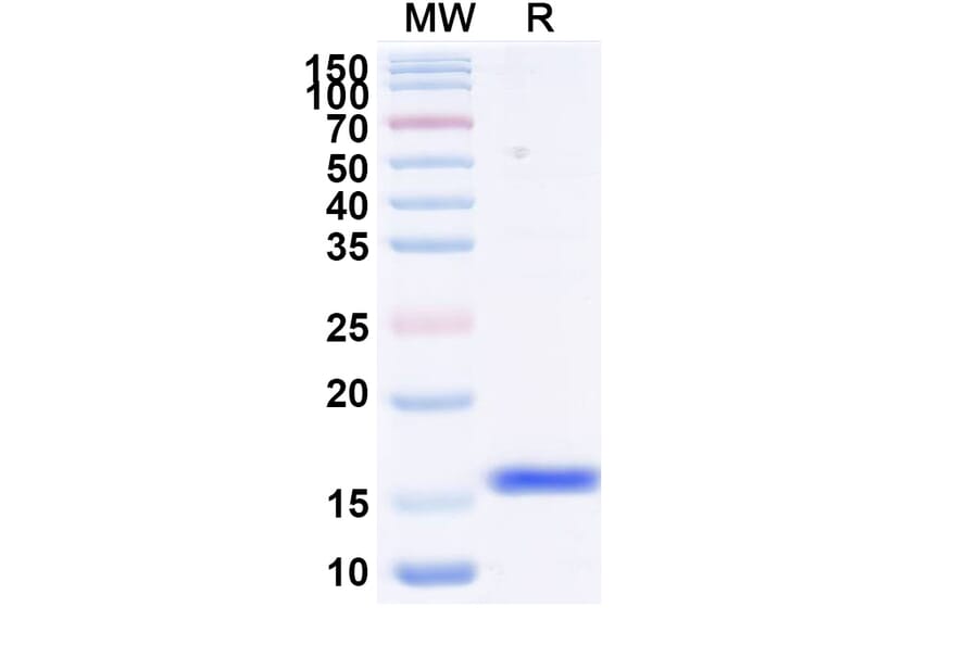 SDS-PAGE - Anti-Fusion Glycoprotein F0 Nanobody [F4] (A337498) - Antibodies.com