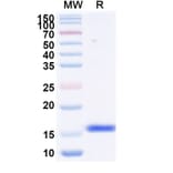 SDS-PAGE - Anti-Fusion Glycoprotein F0 Nanobody [F4] (A337498) - Antibodies.com