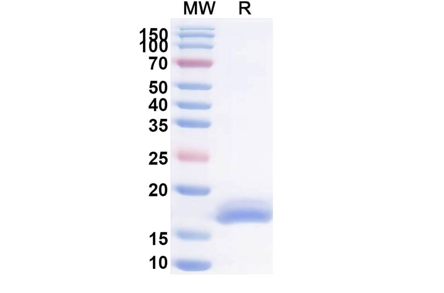 SDS-PAGE - Anti-Fusion Glycoprotein F2 Nanobody [Cl184] (A337500) - Antibodies.com