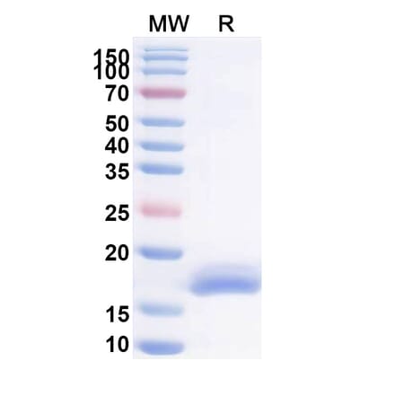 SDS-PAGE - Anti-Fusion Glycoprotein F2 Nanobody [Cl184] (A337500) - Antibodies.com