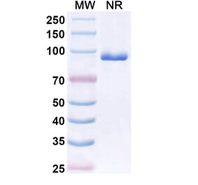SDS-PAGE - Anti-CX3CR1 Nanobody [BI 655089] (A337504) - Antibodies.com
