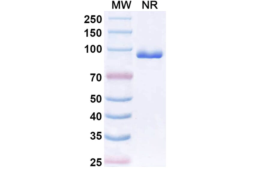 SDS-PAGE - Anti-CX3CR1 Nanobody [BI 655089] (A337504) - Antibodies.com