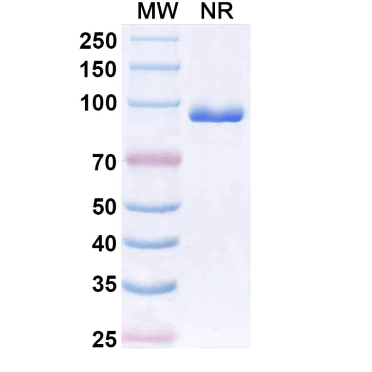 SDS-PAGE - Anti-CX3CR1 Nanobody [BI 655089] (A337504) - Antibodies.com