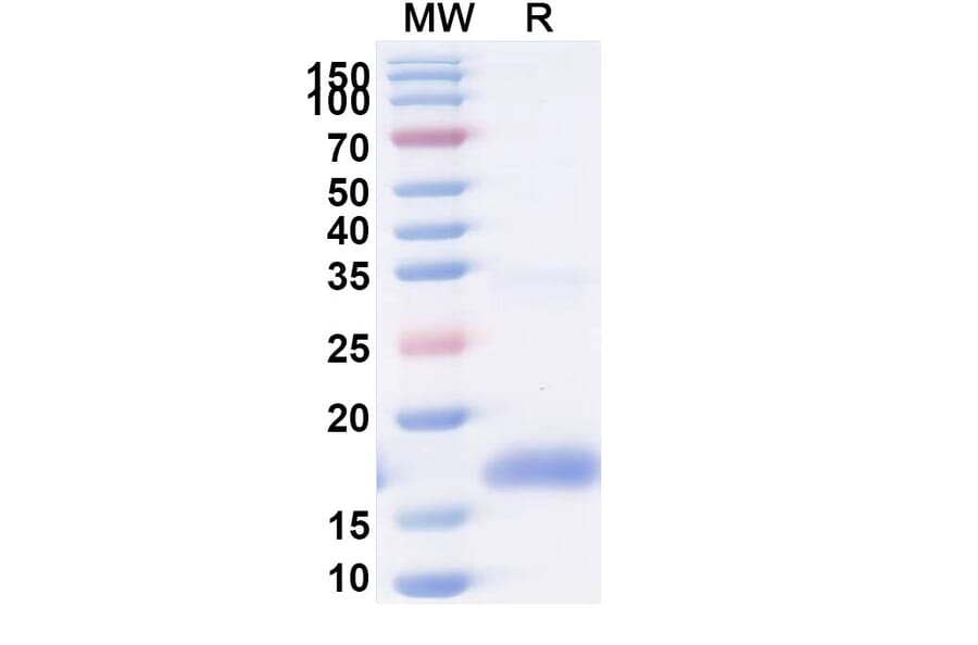 SDS-PAGE - Anti-ITIH4 Nanobody [m36.4] (A337505) - Antibodies.com