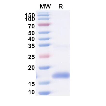 SDS-PAGE - Anti-ITIH4 Nanobody [m36.4] (A337505) - Antibodies.com