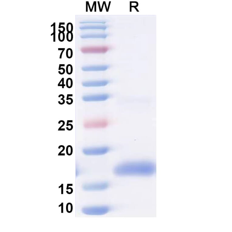 SDS-PAGE - Anti-ITIH4 Nanobody [m36.4] (A337505) - Antibodies.com