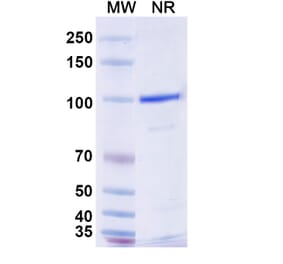 SDS-PAGE - Anti-CLEC9A Nanobody [SAA0484] (A337511) - Antibodies.com