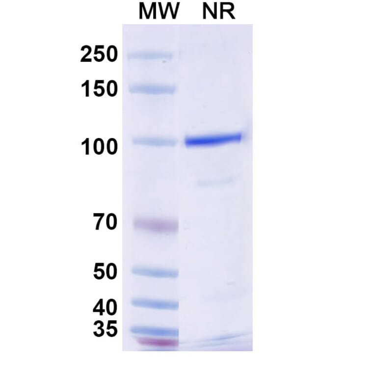 SDS-PAGE - Anti-CLEC9A Nanobody [SAA0484] (A337511) - Antibodies.com