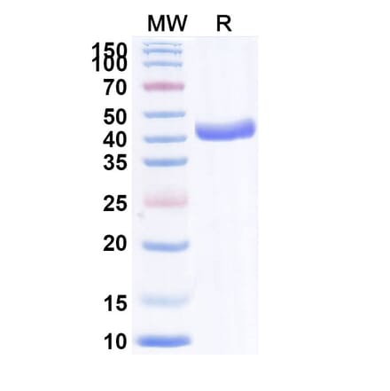 SDS-PAGE - Anti-VHH-mFc Nanobody [cAb-Lys2] (A337515) - Antibodies.com