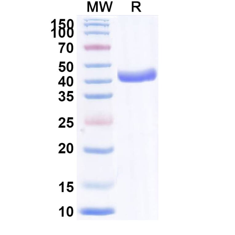 SDS-PAGE - Anti-VHH-mFc Nanobody [cAb-Lys2] (A337515) - Antibodies.com