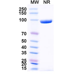 SDS-PAGE - Anti-CXCL11 Nanobody [SAA0466] (A337519) - Antibodies.com