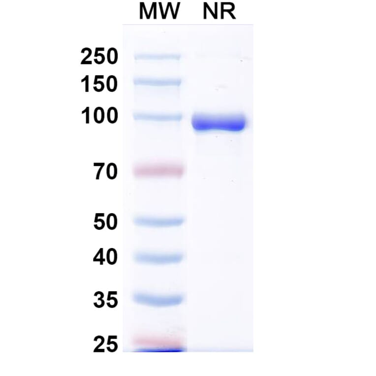 SDS-PAGE - Anti-Fusion Glycoprotein F0 Nanobody [VHHL66] (A337623) - Antibodies.com