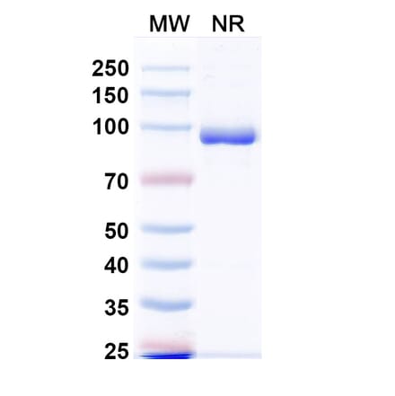 SDS-PAGE - Anti-Fusion Glycoprotein F0 Nanobody [VHH4] (A337624) - Antibodies.com