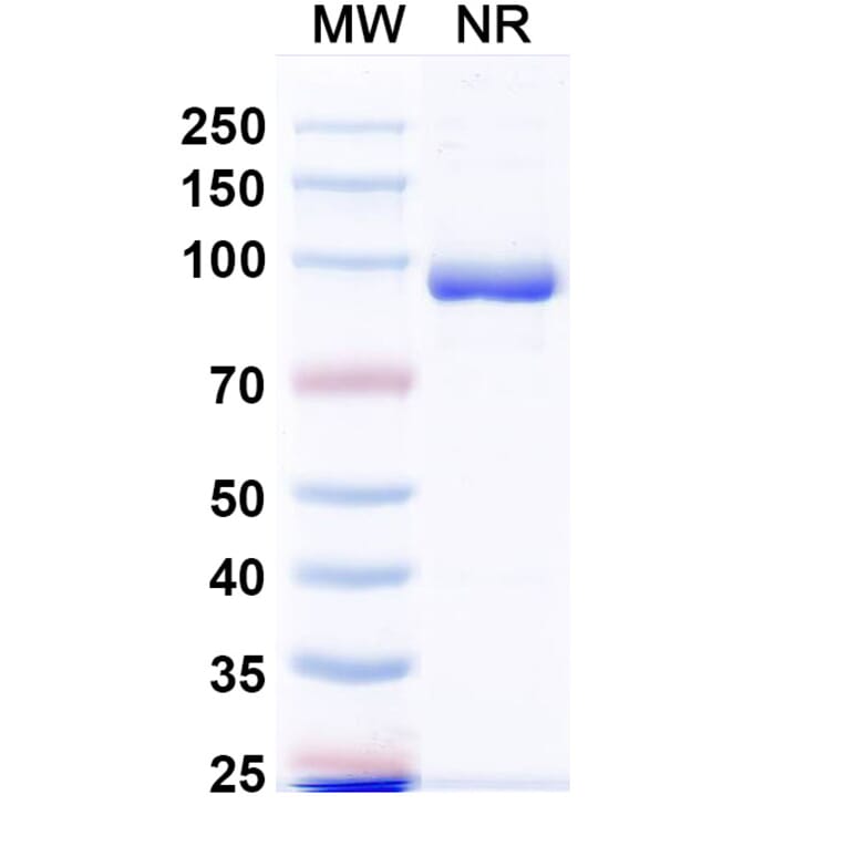 SDS-PAGE - Anti-Fusion Glycoprotein F0 Nanobody [VHH4] (A337624) - Antibodies.com