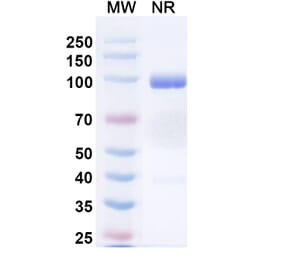 SDS-PAGE - Anti-Nucleoprotein Nanobody [1004] (A337630) - Antibodies.com