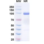 SDS-PAGE - Anti-Nucleoprotein Nanobody [1004] (A337630) - Antibodies.com