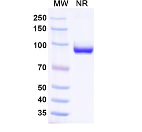 SDS-PAGE - Anti-Nucleoprotein Nanobody [1307] (A337631) - Antibodies.com
