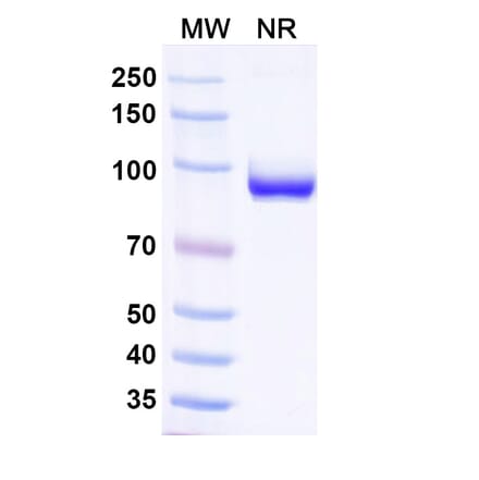 SDS-PAGE - Anti-Nucleoprotein Nanobody [1307] (A337631) - Antibodies.com