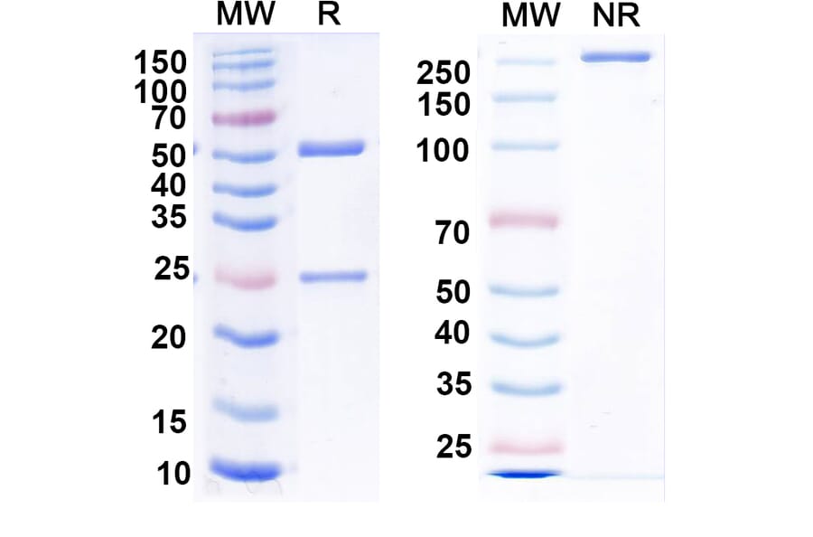 SDS-PAGE - Anti-Nucleoprotein Nanobody [1014] (A337632) - Antibodies.com