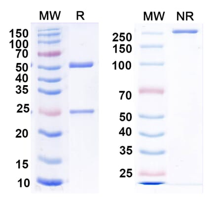 SDS-PAGE - Anti-Nucleoprotein Nanobody [1014] (A337632) - Antibodies.com