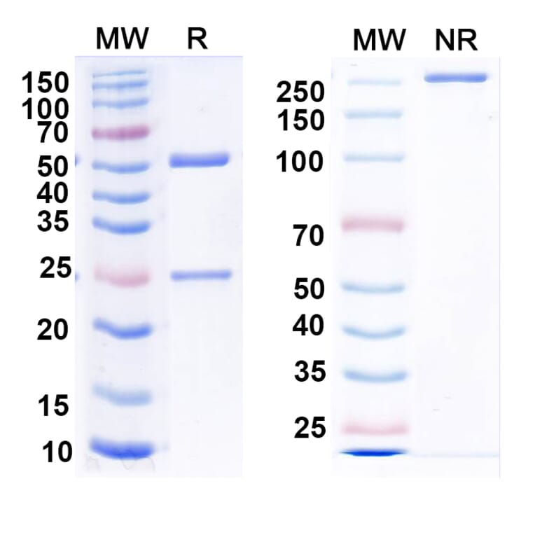 SDS-PAGE - Anti-Nucleoprotein Nanobody [1014] (A337632) - Antibodies.com