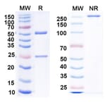 SDS-PAGE - Anti-Nucleoprotein Nanobody [1014] (A337632) - Antibodies.com