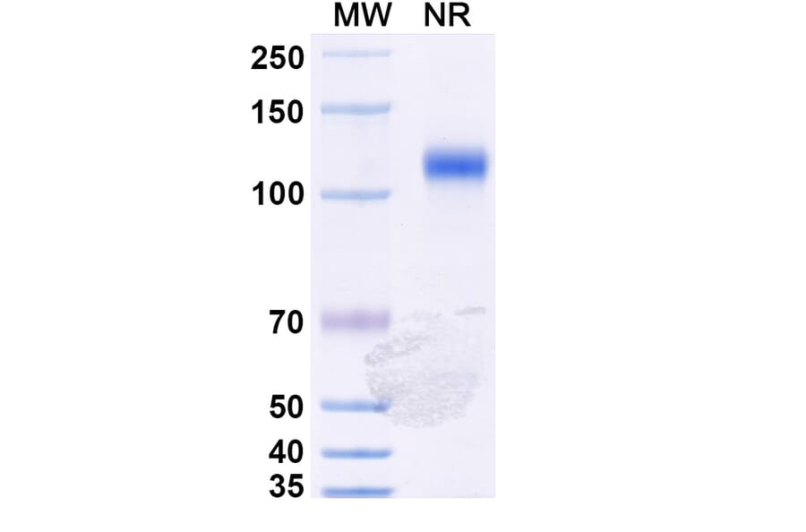 SDS-PAGE - Anti-Nucleoprotein Nanobody [1014] (A337632) - Antibodies.com
