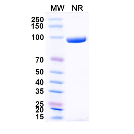 SDS-PAGE - Anti-Nucleoprotein Nanobody [1001] (A337633) - Antibodies.com