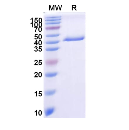 SDS-PAGE - Anti-Tau Nanobody [KW1] (A337637) - Antibodies.com