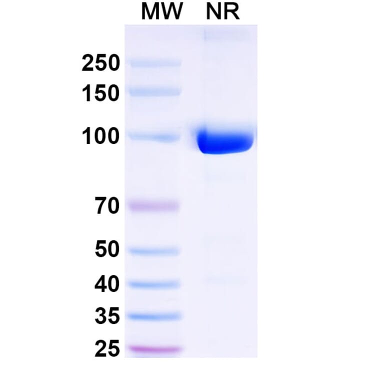 SDS-PAGE - Anti-Internalin B Nanobody [SAA0363] (A337638) - Antibodies.com