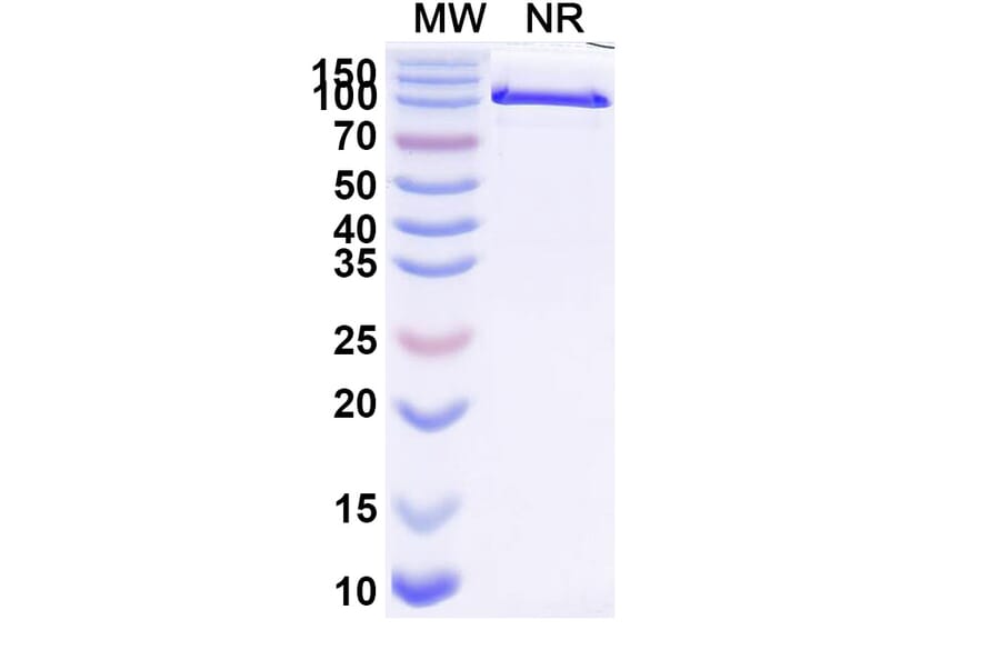 SDS-PAGE - Anti-PD-L1 Nanobody [Iv0040] (A337640) - Antibodies.com