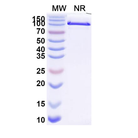 SDS-PAGE - Anti-PD-L1 Nanobody [Iv0040] (A337640) - Antibodies.com