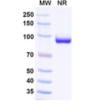 SDS-PAGE - Anti-Nucleoprotein Nanobody [SAA0410] (A337641) - Antibodies.com