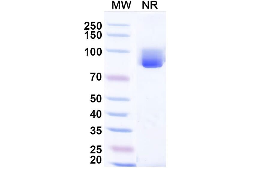 SDS-PAGE - Anti-CCL3 Nanobody [Iv0078] (A337642) - Antibodies.com