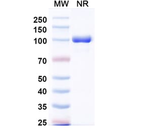 SDS-PAGE - Anti-CXCL11 Nanobody [Iv0089] (A337643) - Antibodies.com