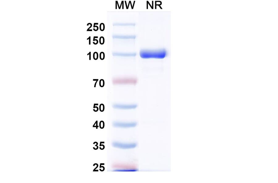 SDS-PAGE - Anti-CXCL11 Nanobody [Iv0089] (A337643) - Antibodies.com