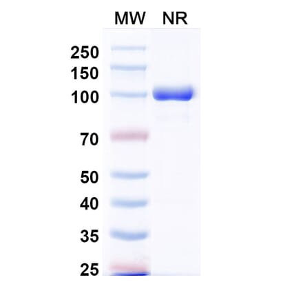 SDS-PAGE - Anti-CXCL11 Nanobody [Iv0089] (A337643) - Antibodies.com