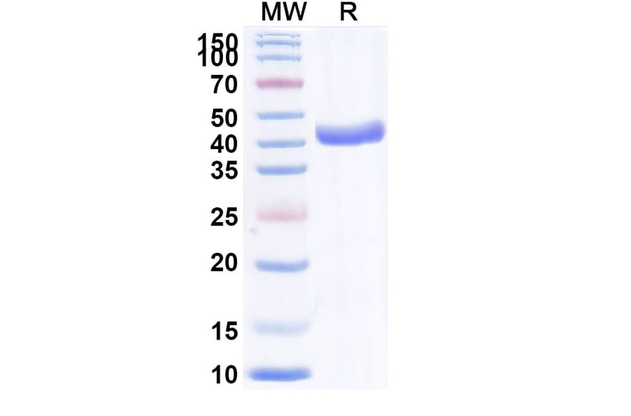 SDS-PAGE - Anti-CXCL11 Nanobody [Iv0089] (A337643) - Antibodies.com