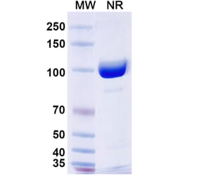 SDS-PAGE - Anti-Thyroglobulin Nanobody [SAA0534] (A337645) - Antibodies.com