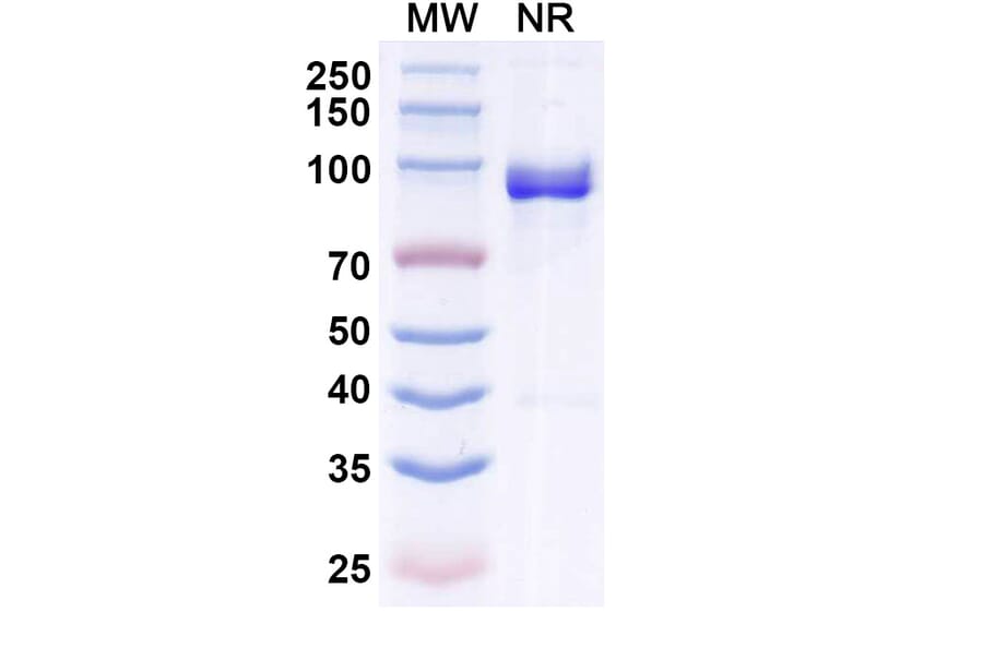 SDS-PAGE - Anti-Allergen Bet v I-A Nanobody [SAA0666] (A337663) - Antibodies.com