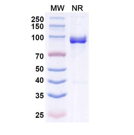 SDS-PAGE - Anti-Allergen Bet v I-A Nanobody [SAA0666] (A337663) - Antibodies.com