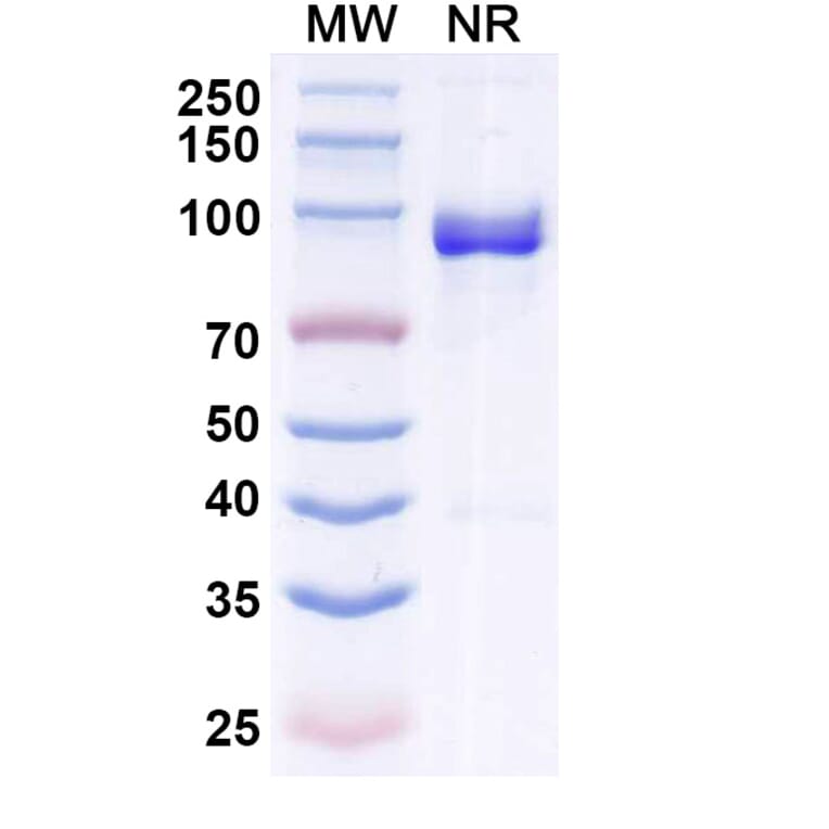 SDS-PAGE - Anti-Allergen Bet v I-A Nanobody [SAA0666] (A337663) - Antibodies.com