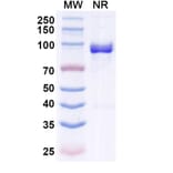SDS-PAGE - Anti-Allergen Bet v I-A Nanobody [SAA0666] (A337663) - Antibodies.com