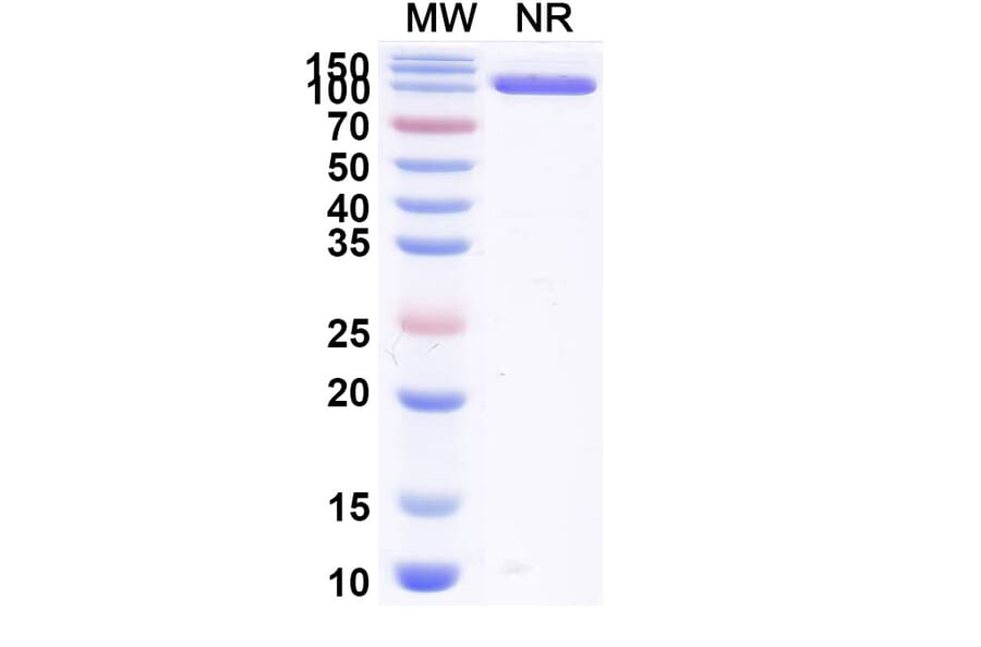 SDS-PAGE - Anti-Allergen Bet v I-A Nanobody [SAA0667] (A337664) - Antibodies.com