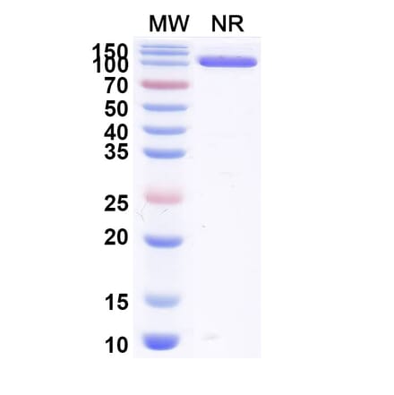 SDS-PAGE - Anti-Allergen Bet v I-A Nanobody [SAA0667] (A337664) - Antibodies.com