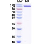 SDS-PAGE - Anti-Allergen Bet v I-A Nanobody [SAA0667] (A337664) - Antibodies.com