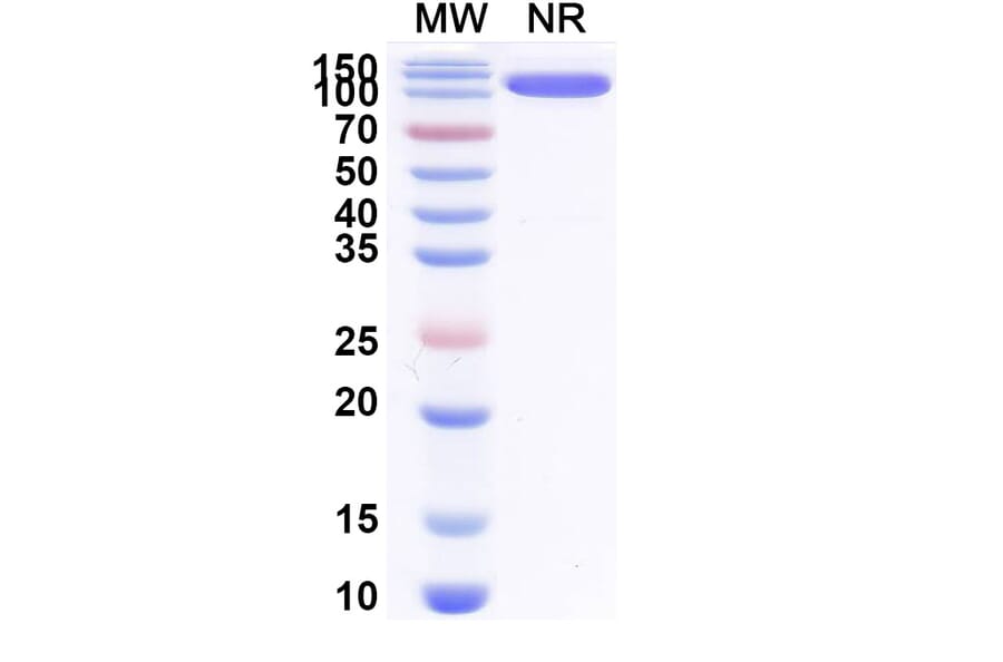 SDS-PAGE - Anti-Allergen Bet v I-A Nanobody [SAA0668] (A337665) - Antibodies.com